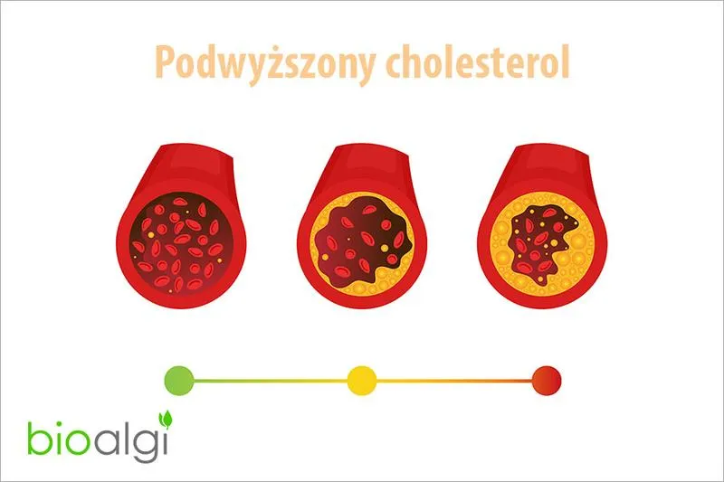 Cholesterol dobry i zły